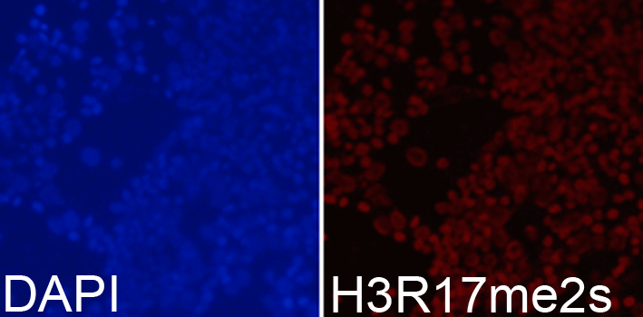Immunofluorescence analysis of 293T cell using Histone H3R17 Dimethyl Symmetric (H3R17me2s) Polyclonal Antibody. Blue: DAPI for nuclear staining.