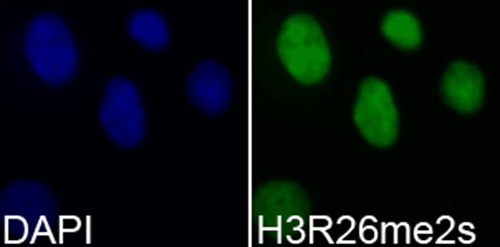 Immunofluorescence analysis of 293T cell using Histone H3R26 Dimethyl Symmetric (H3R26me2s) Polyclonal Antibody. Blue: DAPI for nuclear staining.