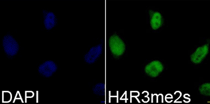 Immunofluorescence analysis of 293T cell using Histone H4R3 Dimethyl Symmetric (H4R3me2s) Polyclonal Antibody. Blue: DAPI for nuclear staining.