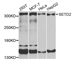 Western blot analysis of extracts of various cells, using SETD2 Polyclonal Antibody.