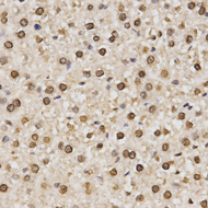 Immunohistochemistry of paraffin-embedded rat liver tissue using Histone H3K14 Dimethyl Polyclonal Antibody at dilution of 1:200 (x400 lens).