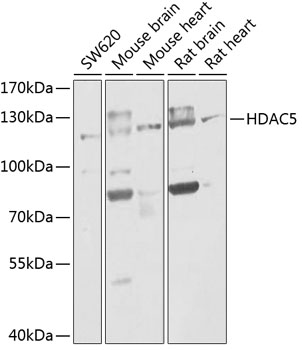 HDAC5 Polyclonal Antibody (50 µl)