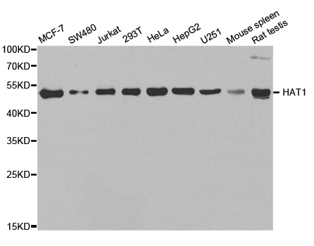 Western blot analysis of extracts of various cell lines, using HAT1 Polyclonal Antibody.