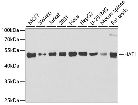 HAT1 Polyclonal Antibody (100 µl)