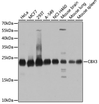 HP1-gamma Polyclonal Antibody (50 µl)
