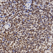 Immunohistochemistry of paraffin-embedded rat spleen tissue using H3K4me1  Monomethyl Polyclonal Antibody  at dilution of 1:200 (x400 lens).