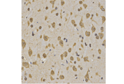 Immunohistochemistry of paraffin-embedded rat brain tissue using Histone H3K4me3 Polyclonal Antibody  at dilution of 1:200 (x400 lens).