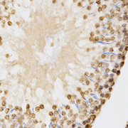Immunohistochemistry of paraffin-embedded rat testis tissue using H3K9me2  Dimethyl Polyclonal Antibody  at dilution of 1:200 (x400 lens).
