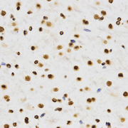 Immunohistochemistry of paraffin-embedded rat brain tissue using H3K9me2  Dimethyl Polyclonal Antibody  at dilution of 1:200 (x400 lens).