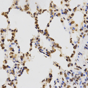 Immunohistochemistry of paraffin-embedded rat lung tissue using H3K9me3  Polyclonal Antibody  at dilution of 1:200 (x400 lens).
