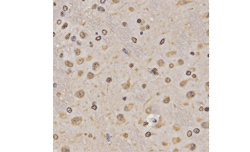 Immunohistochemistry of paraffin-embedded rat brain tissue using H3K36me1 Polyclonal Antibody at dilution of 1:200 (x400 lens).