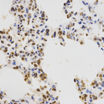 Immunohistochemistry of paraffin-embedded rat lung tissue using Histone H3K36me3 Polyclonal Antibody at dilution of 1:200 (x400 lens).