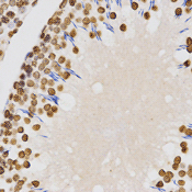 Immunohistochemistry of paraffin-embedded rat testis tissue using Histone H4K20 Dimethyl Polyclonal Antibody at dilution of 1:200 (x400 lens).