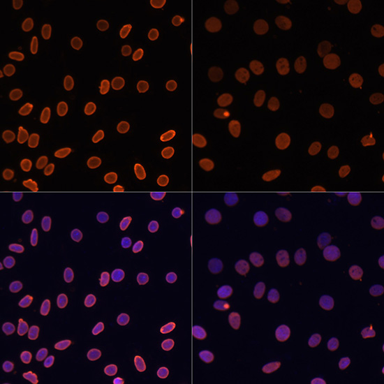 Histone H2AK5ac (Acetyl H2AK5) Polyclonal Antibody (100 µl)