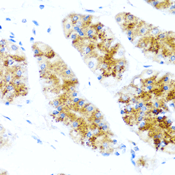 Immunohistochemistry of paraffin-embedded mouse lung using SIRT1 Polyclonal Antibody at dilution of 1:100 (40x lens).