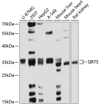 SIRT5 Polyclonal Antibody (100 µl)