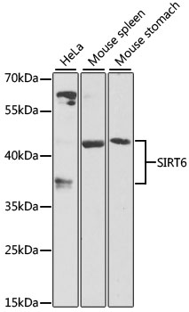 SIRT6 Polyclonal Antibody (100 µl)