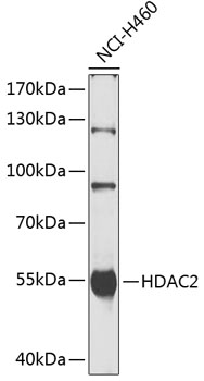 HDAC2 Polyclonal Antibody (50 µl)