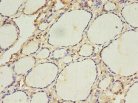 ACAA1 Polyclonal Antibody (20 µl)