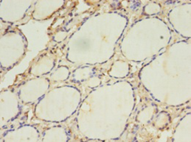 ACAA1 Polyclonal Antibody