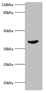 ADA Polyclonal Antibody (20 µl)