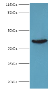 ADA Polyclonal Antibody