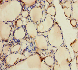 AK1 Polyclonal Antibody