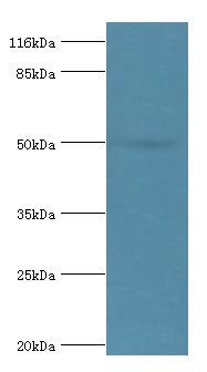 ALDH3A1 Polyclonal Antibody