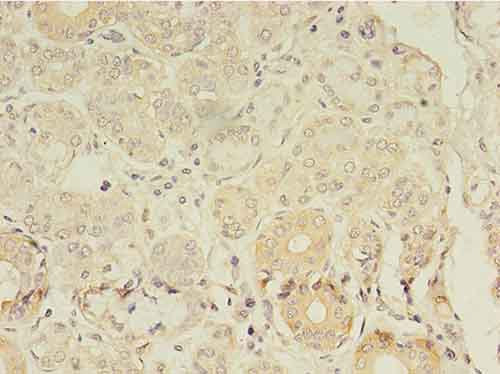 Immunohistochemistry of paraffin-embedded human salivary gland tissue at dilution 1:100