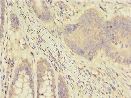 APOD Polyclonal Antibody