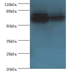 ATP5A1 Polyclonal Antibody