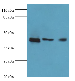 ATXN3 Polyclonal Antibody