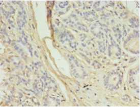 AURKB Polyclonal Antibody