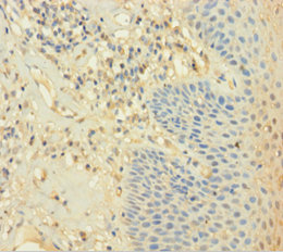 CAPZA2 Polyclonal Antibody