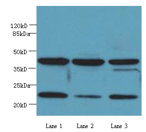 CBX5 Polyclonal Antibody