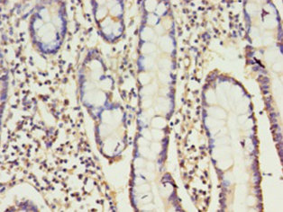 Immunohistochemistry of paraffin-embedded human small intestine at dilution 1:100