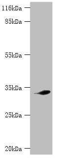 Western blot<br />All lanes: CDK5 Polyclonal Antibody at 2ug/ml+mouse brain tissue<br />Secondary<br />Goat polyclonal to rabbit at 1/10000 dilution<br />Predicted band size: 34, 30 kDa<br />Observed band size: 33 kDa<br />