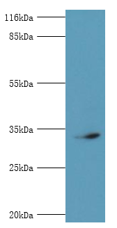 CDK5 Polyclonal Antibody