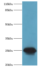 CSHL1 Polyclonal Antibody