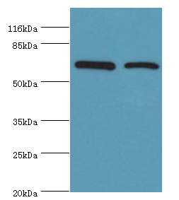 CTPS1 Polyclonal Antibody