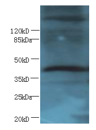 CXCR4 Polyclonal Antibody