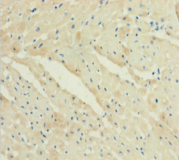Immunohistochemistry of paraffin-embedded human heart tissue using CYGB Polyclonal Antibody at dilution 1:100