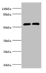 CYP2E1 Polyclonal Antibody (100 µl)