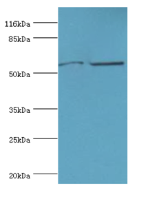 CYP2E1 Polyclonal Antibody