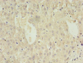 Immunohistochemistry of paraffin-embedded human liver tissue at dilution 1:100