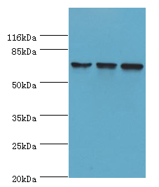 DDX3X Polyclonal Antibody