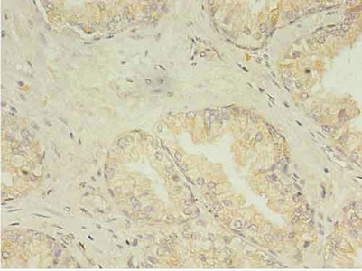 Immunohistochemistry of paraffin-embedded human prostate using DDX3X Polyclonal Antibody at dilution 1:100.