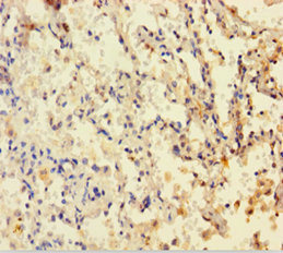 DHFR Polyclonal Antibody