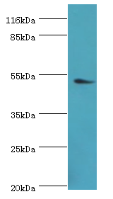 DRD5 Polyclonal Antibody