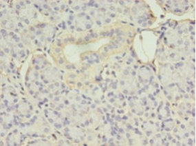 Immunohistochemistry of paraffin-embedded human pancreas tissue at dilution 1:100